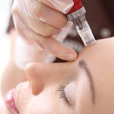 Microneedling Visage