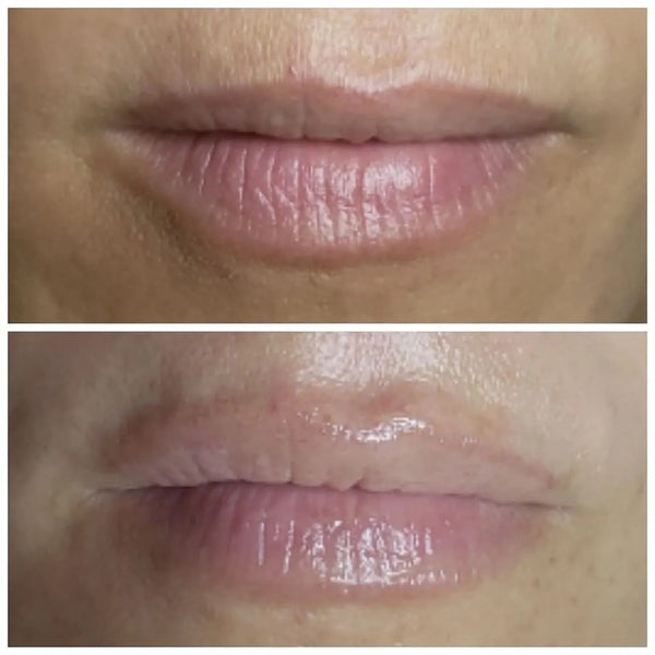 Masque Collagen Rehab