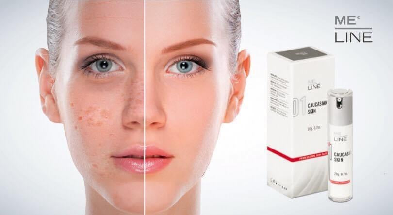 Facial MeLine